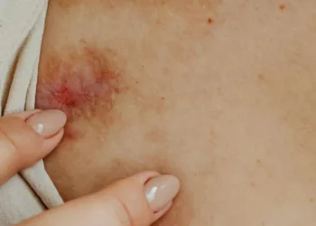 Mulher é agredida pela companheira e chega na delegacia com diversas lesões em Jaraguá do Sul