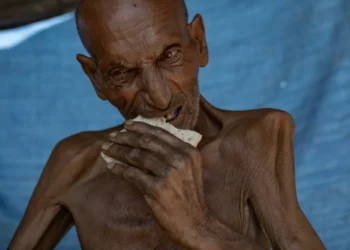 Israel afirma que não há ‘desnutrição generalizada’ em Gaza